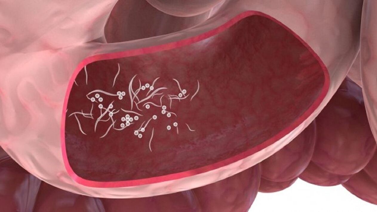 Pasożyty Giardia w wątrobie