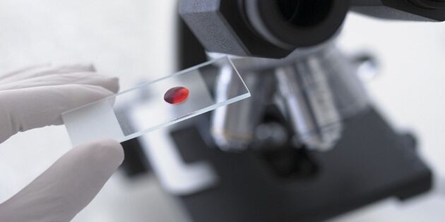 badanie krwi w celu zdiagnozowania pasożytów w organizmie