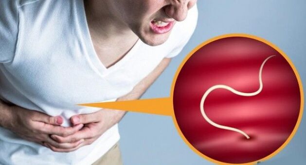 ból brzucha wywołany pasożytami