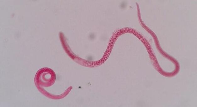 jak wygląda włośnica