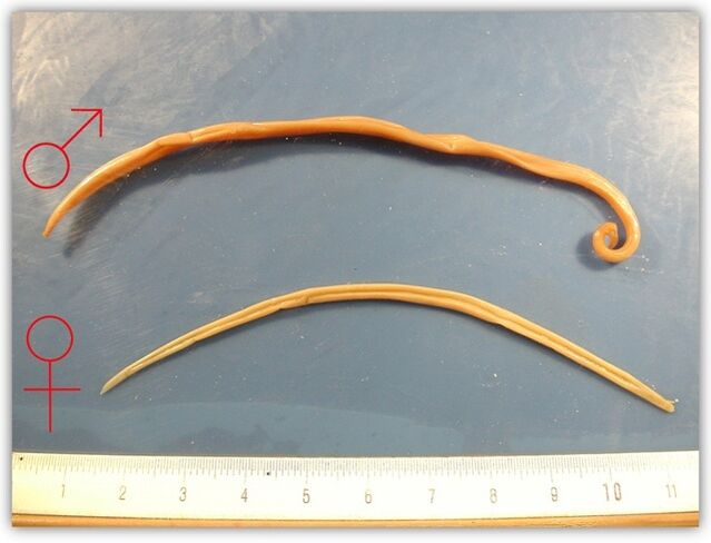 jak wyglądają glisty